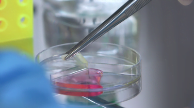 Dente de leite no laboratório da R-Crio: a retirada das células-tronco depende de um protocolo específico de extração e preservação.