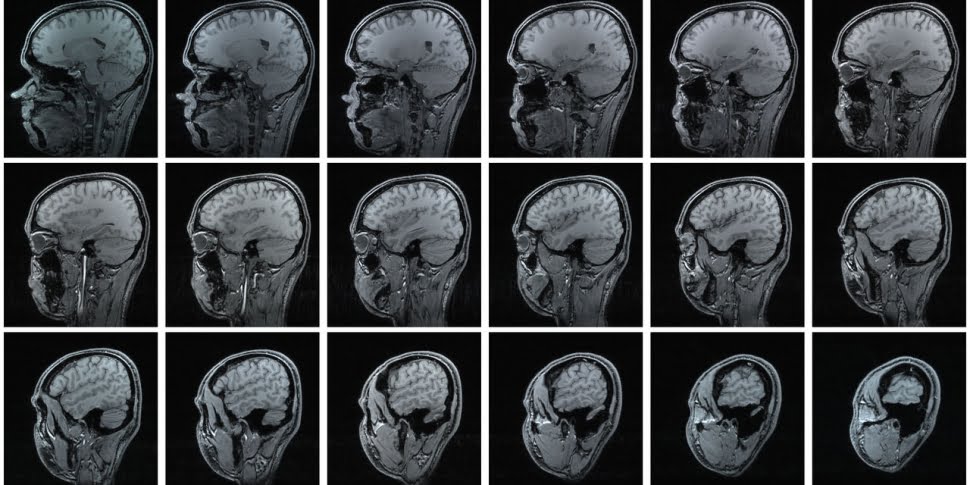 Em busca de respostas mais viscerais, literalmente, essa técnica usa ressonância magnética, eletroencefalografia, codificação facial e rastreamento ocular para entender as escolhas de consumo.