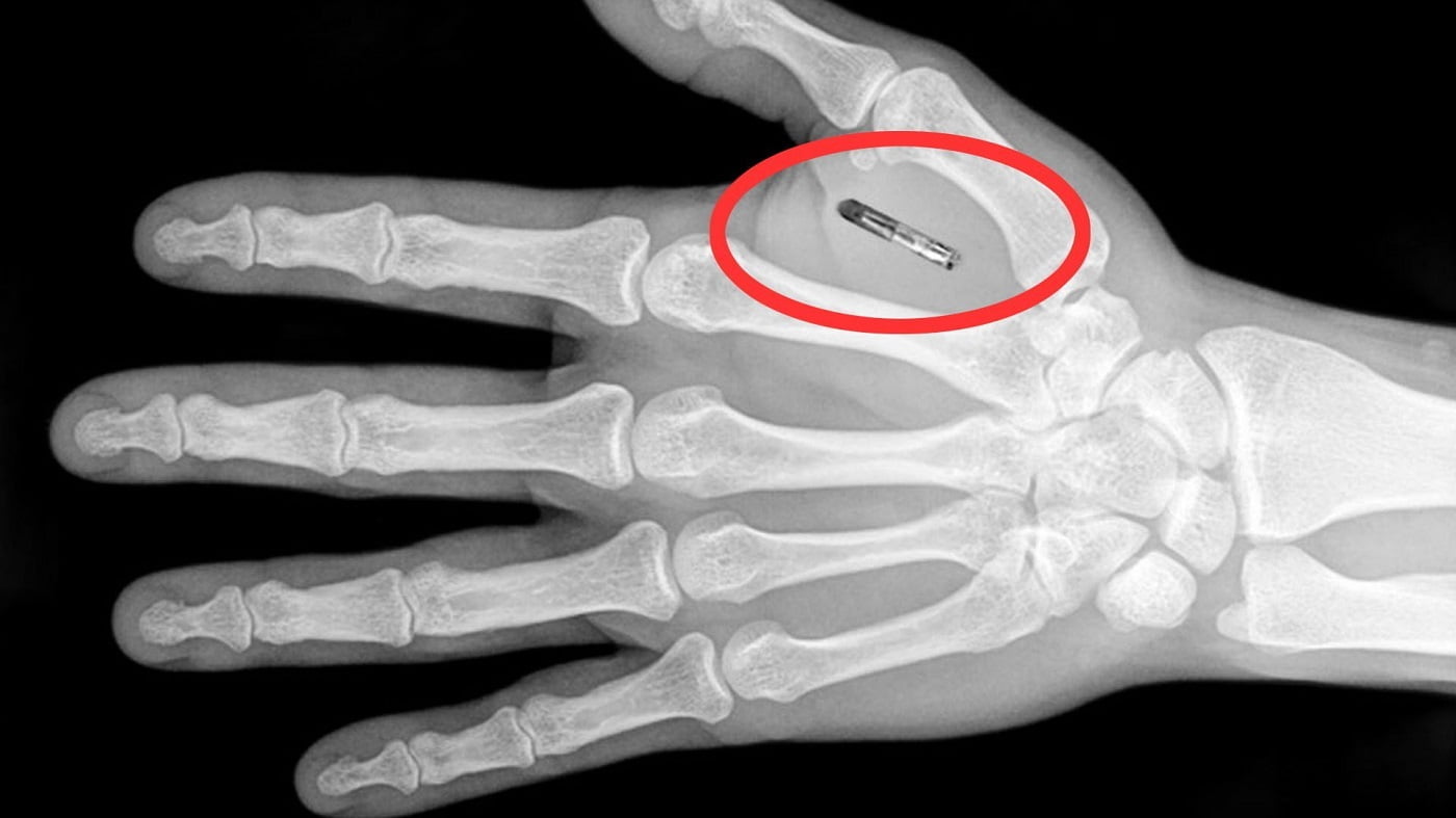 O implante de microchips já é uma das possibilidades de Transumanismo testada, inclusive, em funcionários de uma empresa americana (Imagem: Youtube/Reprodução).
